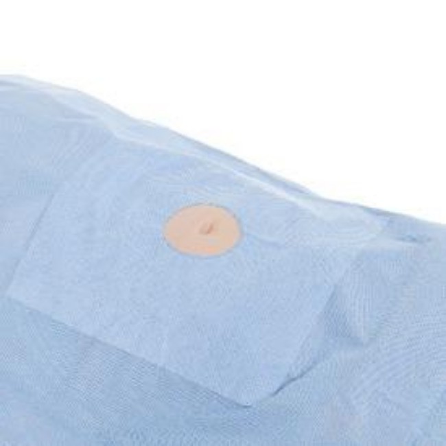 DRAPE PROCEDURE MINOR FEN 48X60 STERILE