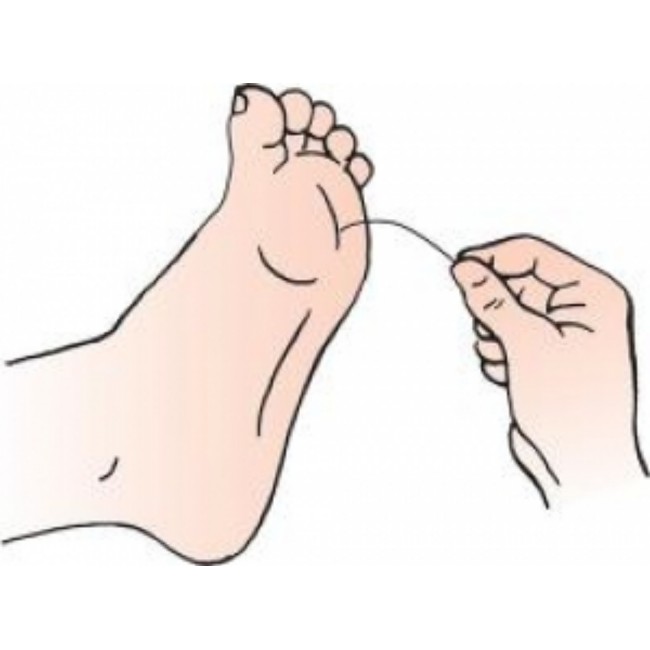 Test  Monofilament  Diabetic  Gry Foot Hndl