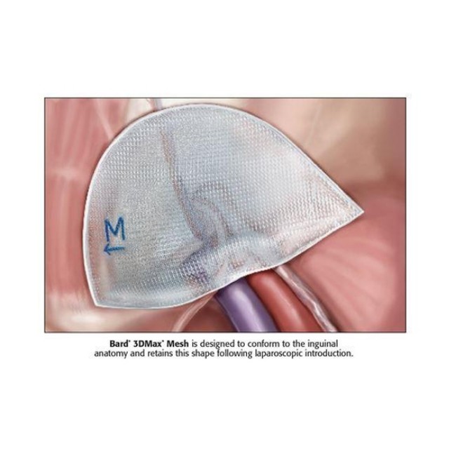 MESH 3DMAX RIGHT MEDIUM 3X5