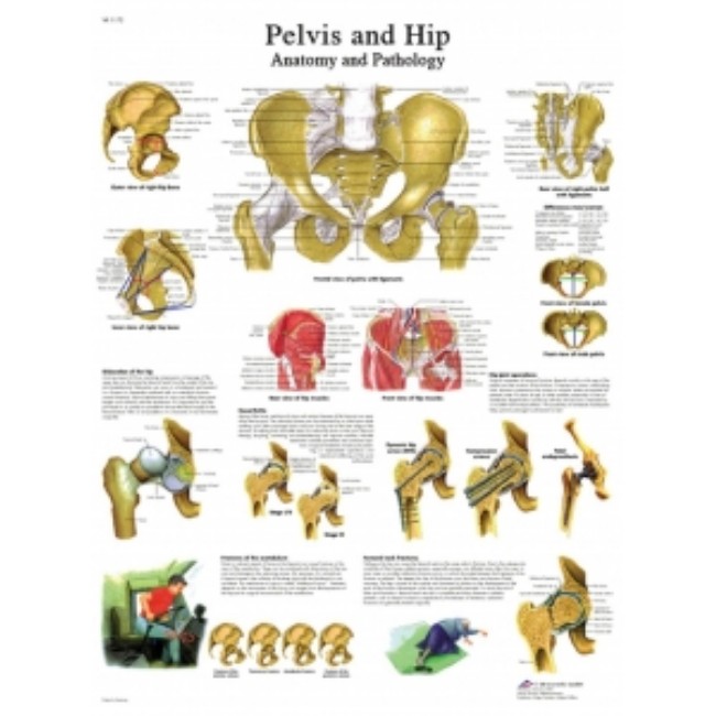 Chart  Anatomical  Hip   Pelvis   Laminated