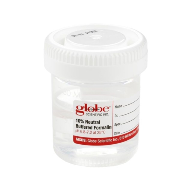 Prefilled Formalin Container Tite Rite  48 X 60 Mm 30 Ml Fill In 60 Ml Screw Cap Warning Label   Patient Information Nonsterile