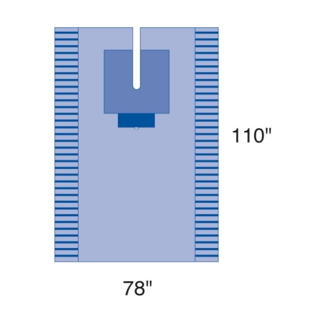 Drape Pack    Surgical Eent Head   Neck With Bar