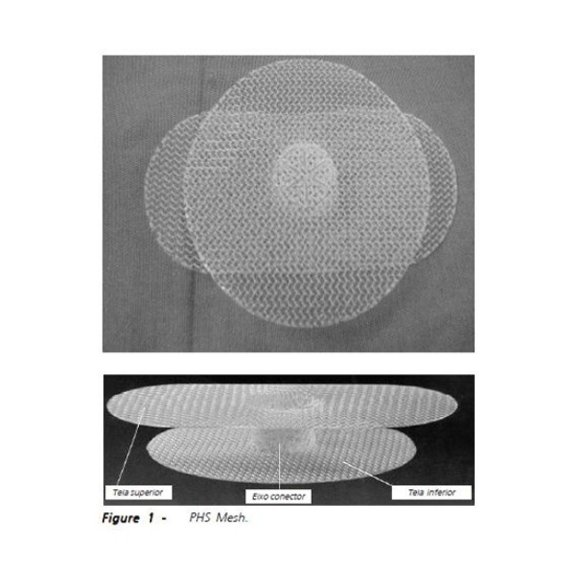 Mesh  Soft Prolene Mesh   6  X 6 