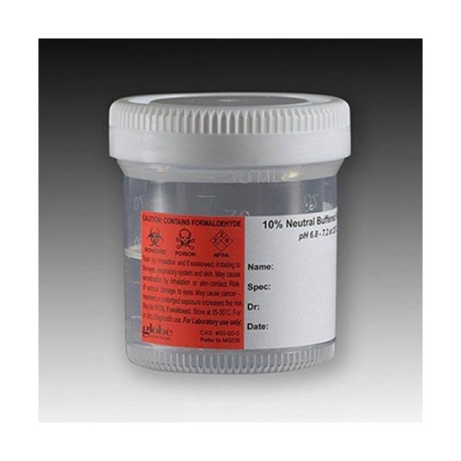 Formalin   Neautral Buffered Prefill 20Ml